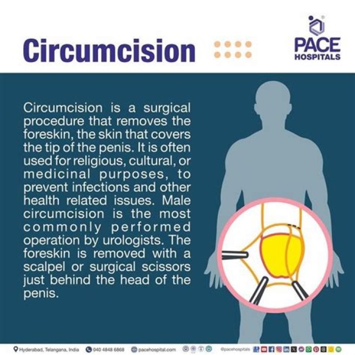 Can circumcision be done twice?