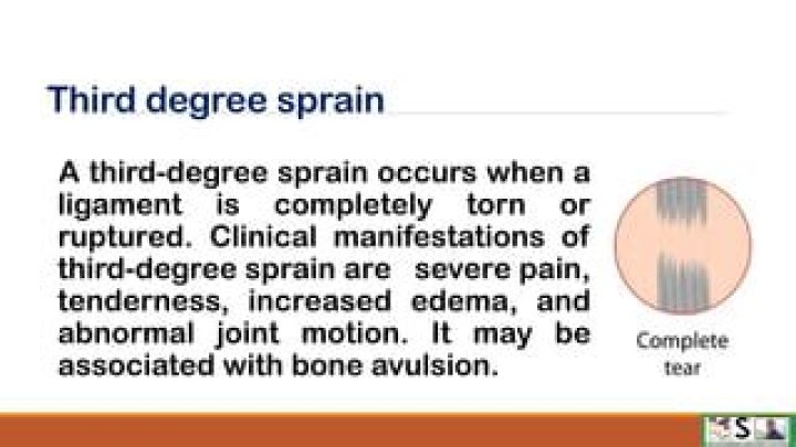 Does a third degree sprain require surgery?