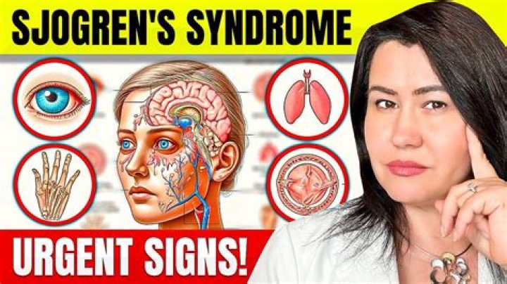 Does Sjogren's affect your heart?