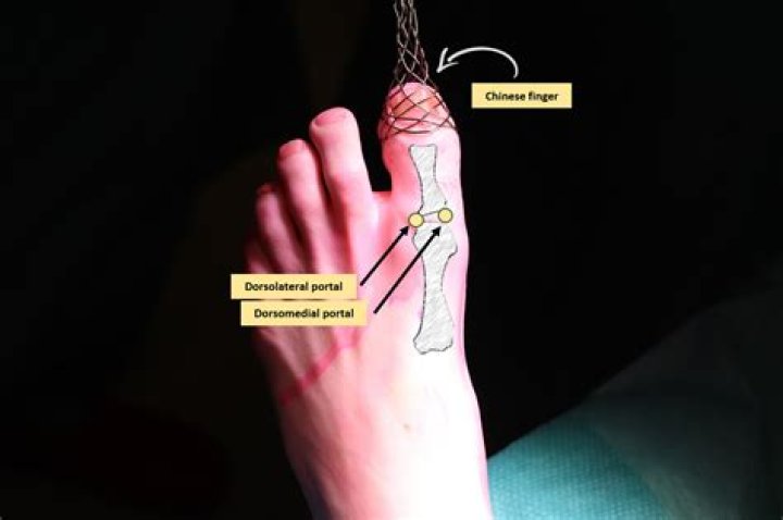 How common is joint ill?