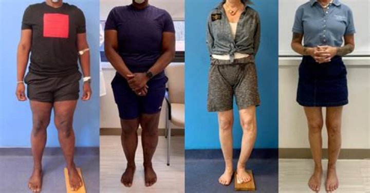 How do you tell if one leg is shorter than the other?