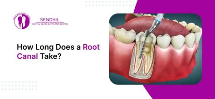 How long does a root Tap last?