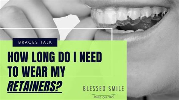 How long is too long for braces?