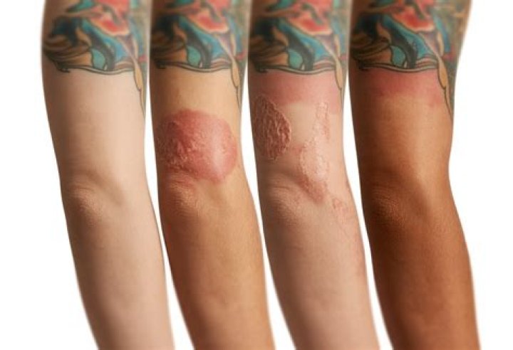 How long will a tattoo itch?