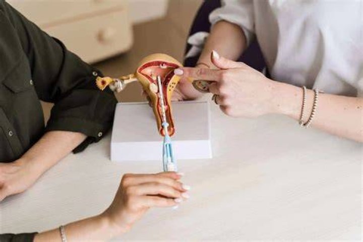 Is an IUD worth it?
