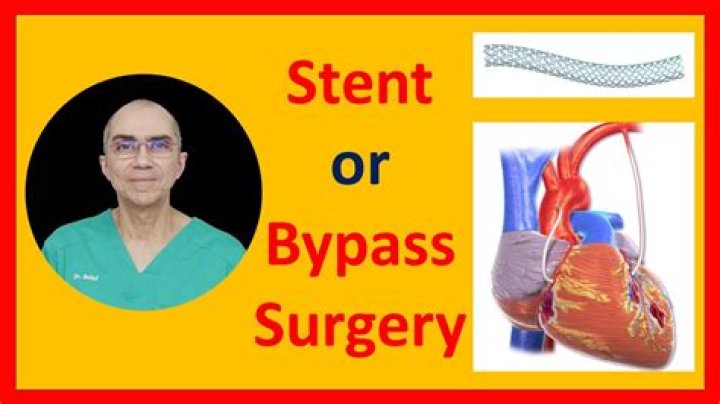 Which is better bypass or stent?
