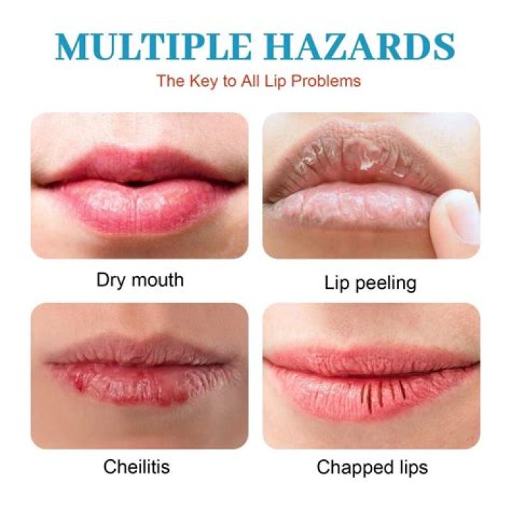 Why does my 2 year old have blue lips?